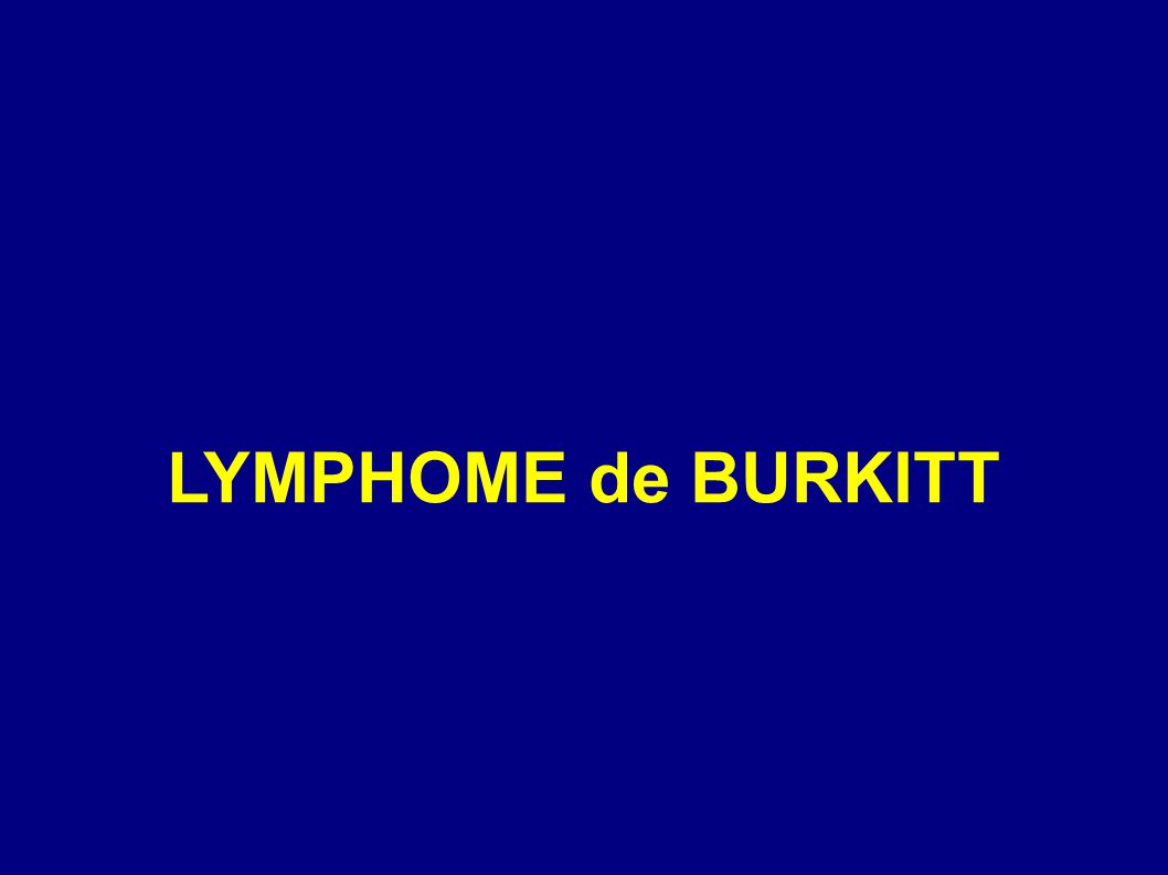 LYMPHOME de BURKITT