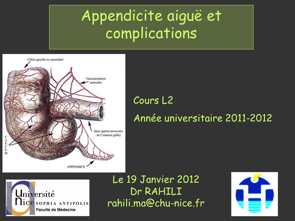 Appendicite aiguë et complications .PDF