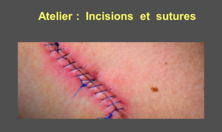 Atelier : Incisions et sutures .PDF