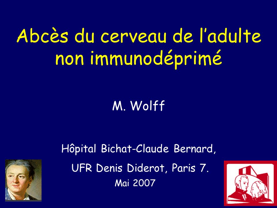 Abcès du cerveau de l’adulte non immunodéprimé .PDF