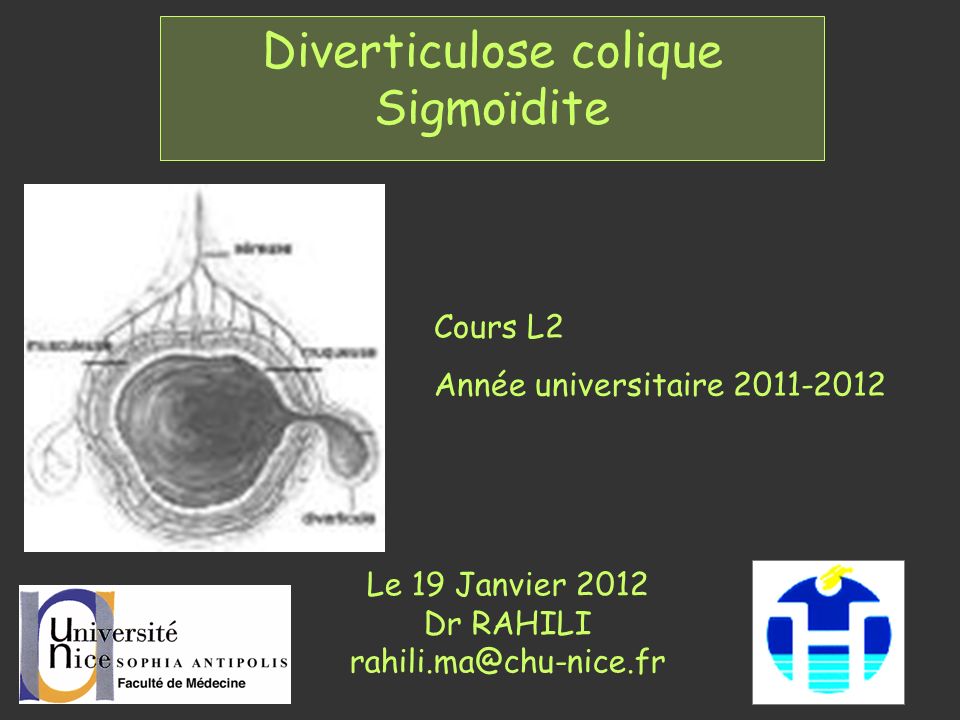 Diverticulose colique Sigmoïdite .PDF - ETUDE-AZ