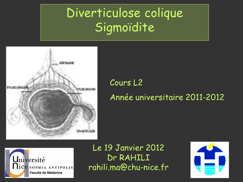 Diverticulose colique Sigmoïdite .PDF
