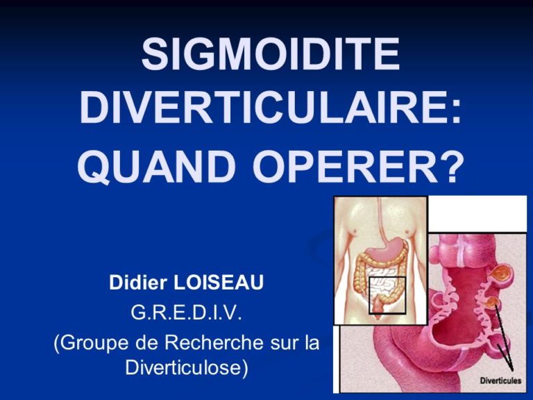 SIGMOIDITE DIVERTICULAIRE QUAND OPERER .PDF ETUDEAZ — free download