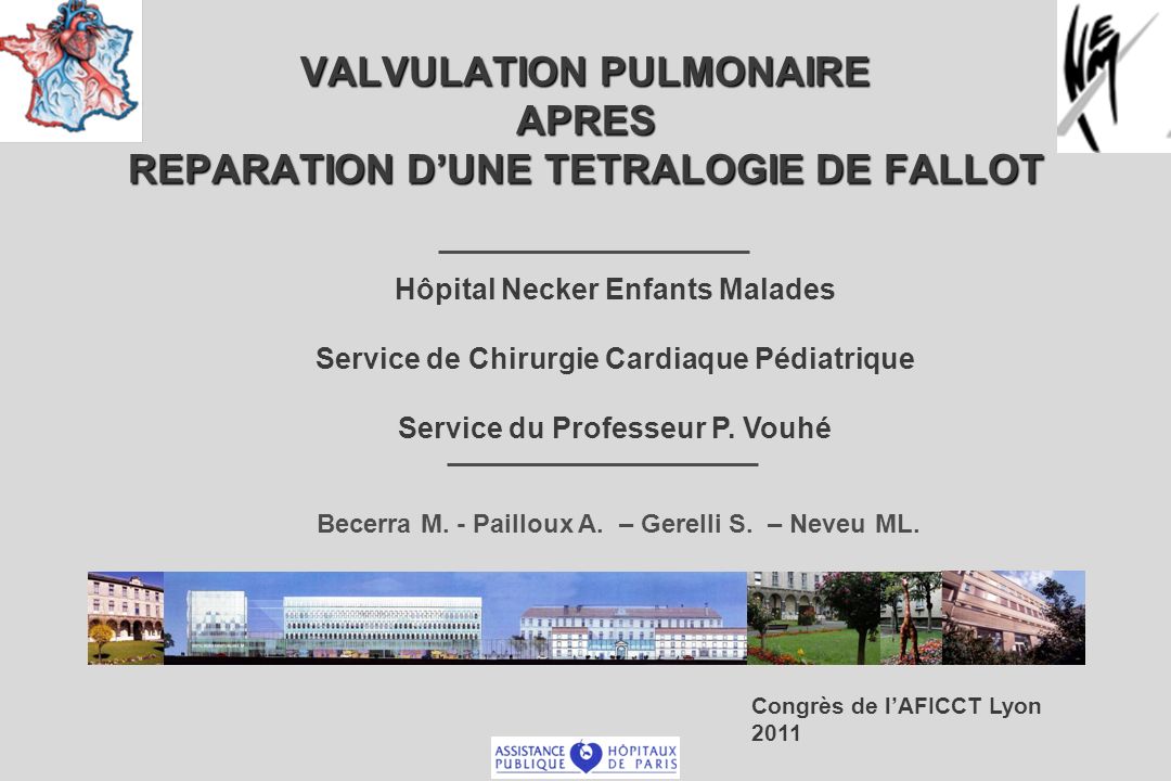 VALVULATION PULMONAIRE APRES REPARATION D’UNE TETRALOGIE DE FALLOT .PDF