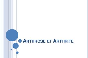 Arthrose et arthrite .PDF