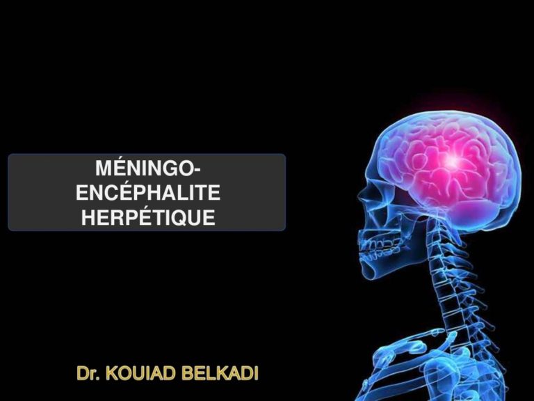 Méningo encéphalite herpétique .PDF - ETUDE-AZ
