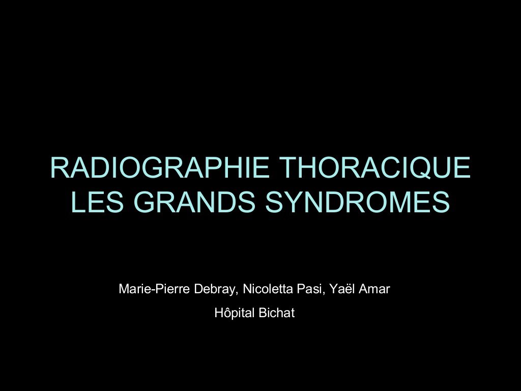 RADIOGRAPHIE THORACIQUE LES GRANDS SYNDROMES .PDF