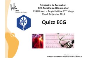 Quizz ECG .QCM (PDF)