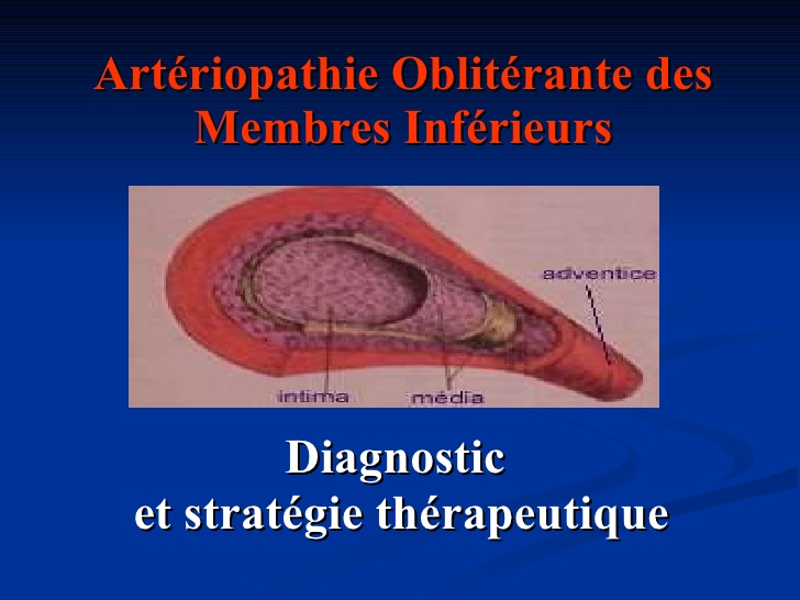 Art riopathie Oblit rante Des Membres Inf rieurs PDF ETUDE AZ art-riopathie-oblit-rante-des-membres-inf-rieurs-pdf-etude-az