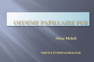 Oedèmes papillaires purs .PDF
