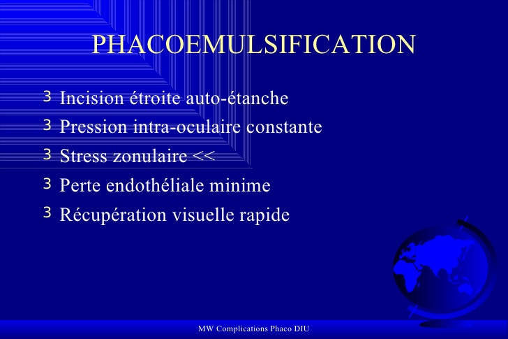 Complications Phacoémulsification .PDF
