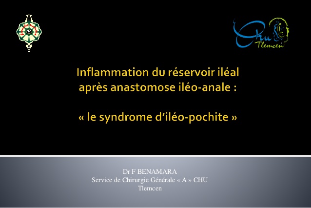 Le syndrome d’iléo pochite .PDF