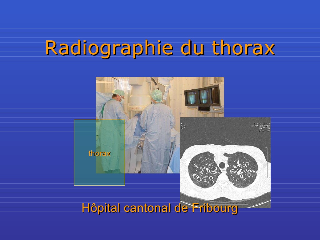 Radiographie du thorax .PDF