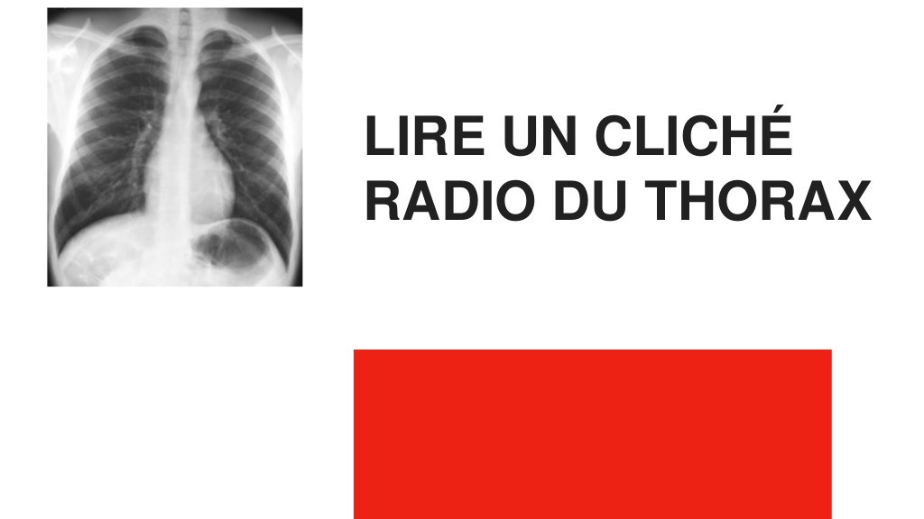 Lire un cliché radio du thorax .PDF