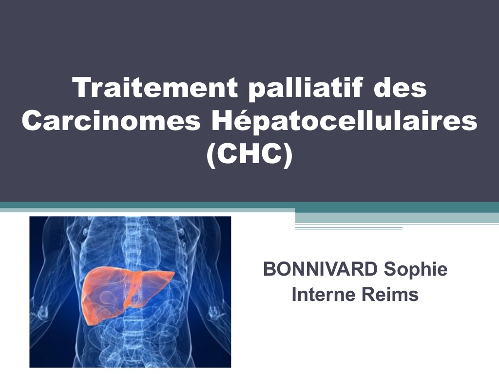 Traitement palliatif des Carcinomes Hépatocellulaires .PDF