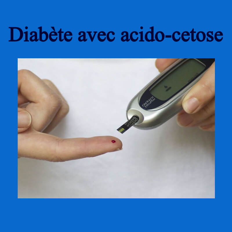 Diabète avec acido-cetose .PDF