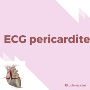 ECG pericardite