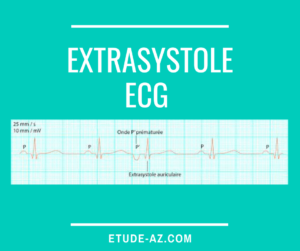 Extrasystole ECG
