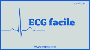ECG facile pdf